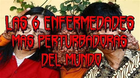 pesoree|peores enfermedades.